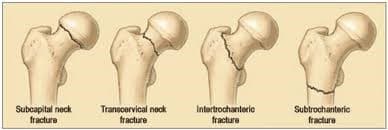 Түнхний үе солих мэс засал гэж юу вэ image11