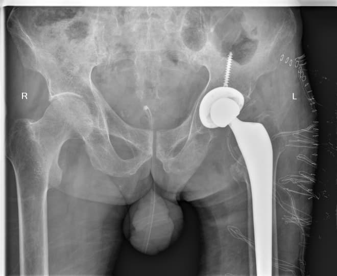 Түнхний үе солих мэс засал гэж юу вэ image13