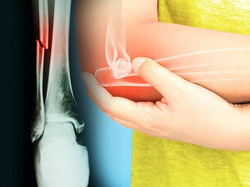 Хугарал засах мэс засал image3