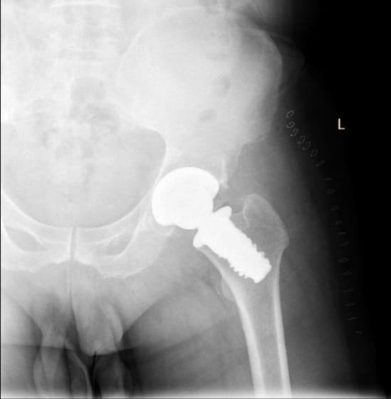 Түнхний үе солих мэс засал гэж юу вэ image7