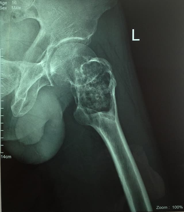 Түнхний үе солих мэс засал гэж юу вэ image8