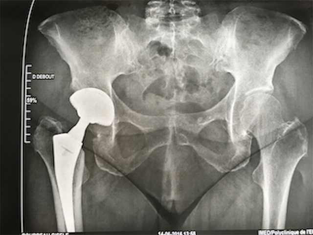 Хугарал засах мэс засал image9